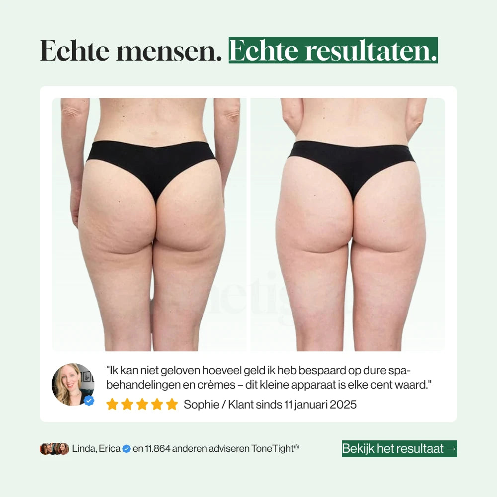 ToneTight® SmoothSkin Pro